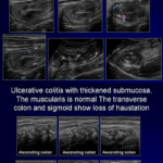Medical Imaging Worksheet Answers